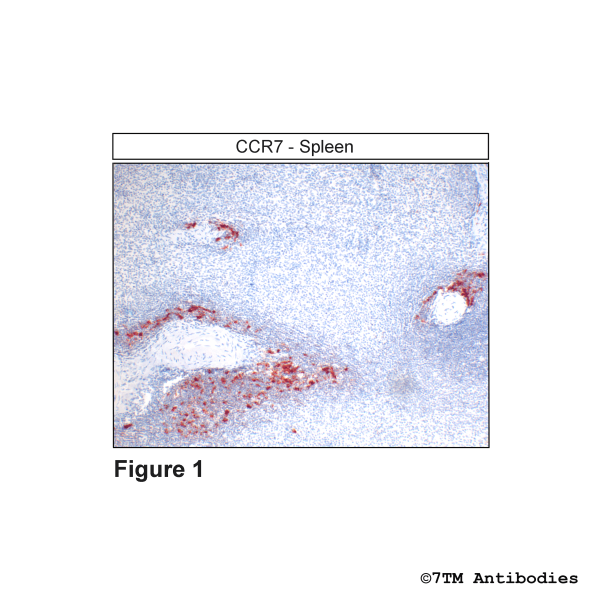  Immunohistochemical identification of CC Chemokine Receptor 7 in human spleen