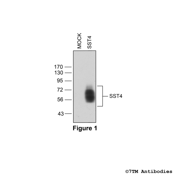 SST4 [UMB9] (RM-non-phospho), Somatostatin Receptor 4 Antibody, Rabbit Monoclonal