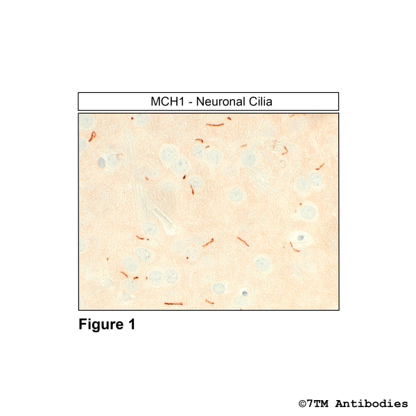 Immunohistochemical identification of Melanin-Concentrating Hormone Receptor 1 in neuronal cilia