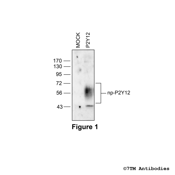 P2Y12 (non-phospho) P2Y Purinoceptor 12 Antibody)