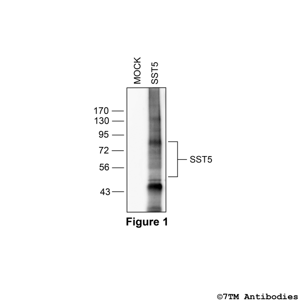 SST5 (non-phospho), Somatostatin Receptor 5 Antibody