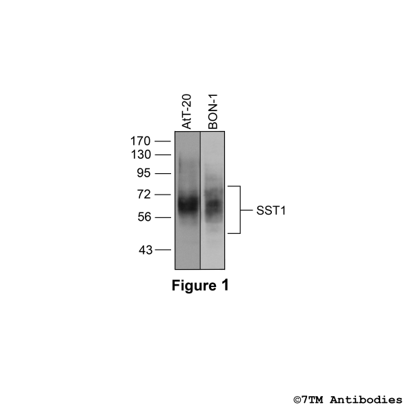 Western blot analysis of Somatostatin Receptor 1 in membrane preparations from cells of AtT-20 and BON-1 cell lines.