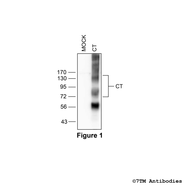 Validation of the Calcitonin Receptor in transfected HEK293 cells