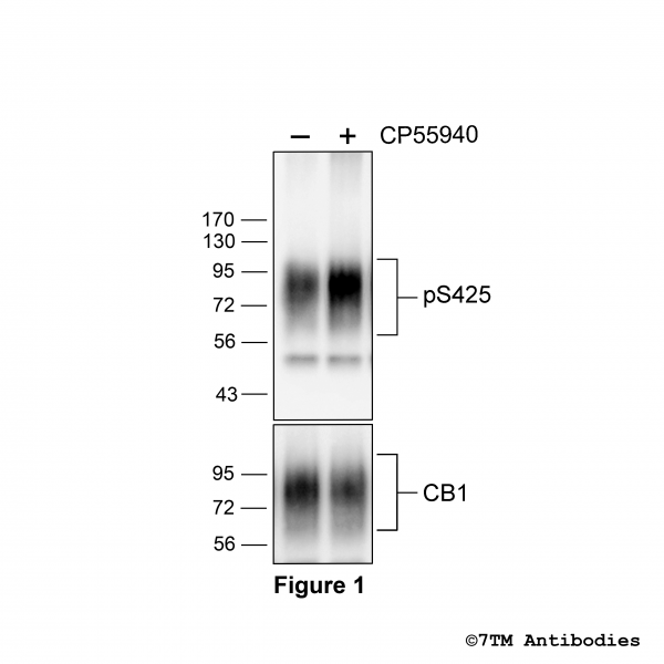 Agonist-induced Serine425 phosphorylation of the Cannabinoid Receptor 1