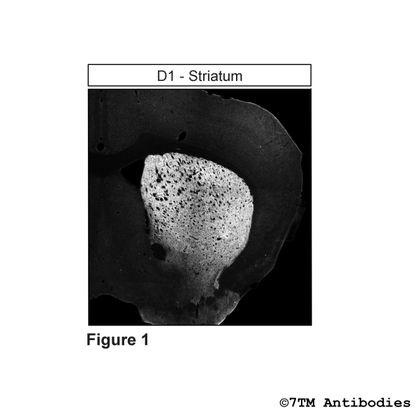 D1 [UMB10] (RM-IHC-grade), Dopamine Receptor 1 Antibody, Rabbit Monoclonal