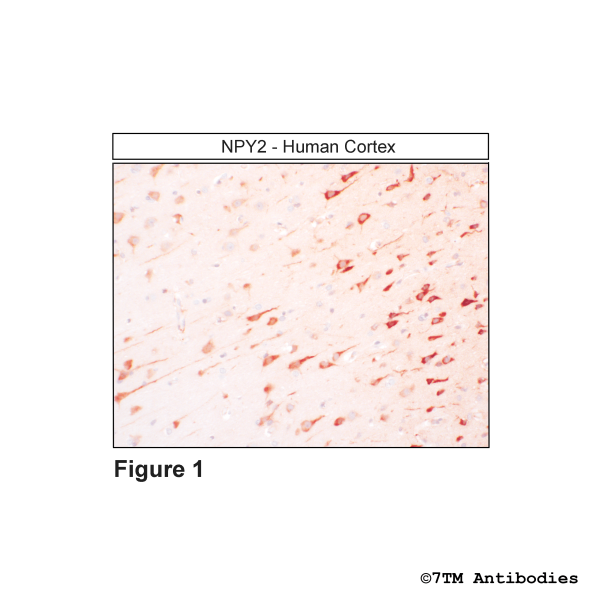 Immunohistochemical identification of Neuropeptide Y Receptor 2 in human cortex
