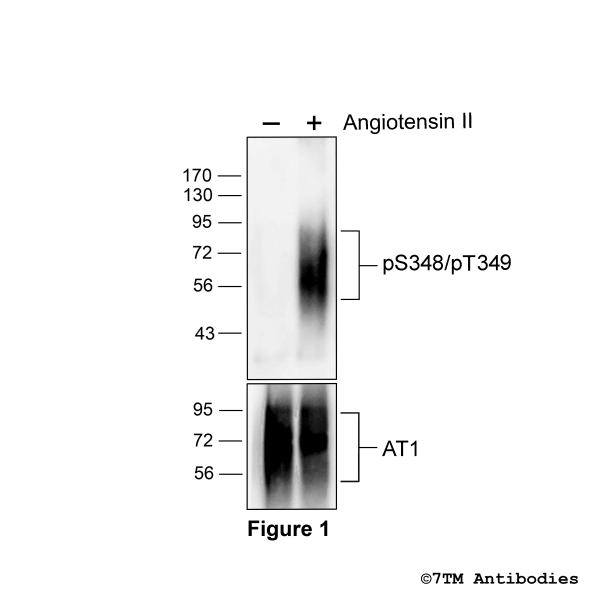 Agonist-induced Serine348/Threonine349 phosphorylation of the Angiotensin Receptor 1