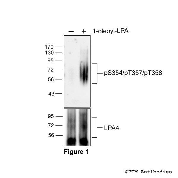 Agonist-induced Serine354/Threonine357/Threonine358 phosphorylation of the Lysophosphatidic Acid Receptor 4