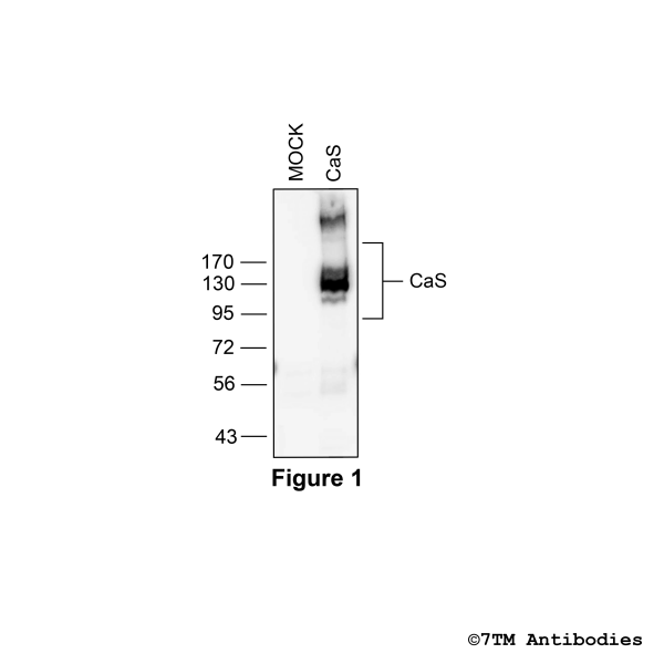 CaS (non-phospho), Calcium-sensing Receptor Antibody