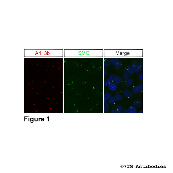 Immunohistochemical identification of Smoothened Receptor in cilia