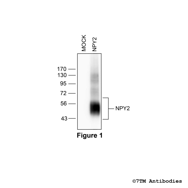 NPY2 (non-phospho) Neuropeptide Y Receptor 2 Antibody