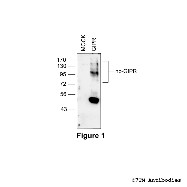 GIPR (non-phospho) Gastric Inhibitory Polypeptide Receptor Antibody